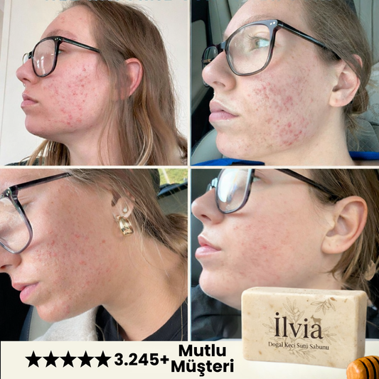 İlvia: Kostiksiz Geleneksel Keçi Sütü Sabunu